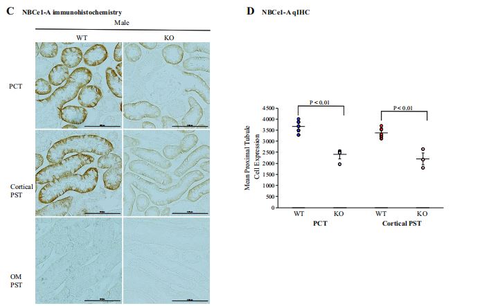 Figure 6. Effect of androgen receptor (AR) deletion on electrogenic Naþ -bicarbonate cotransporter 1 (NBCe1) expression. A: immunoblot analysis using a pan-NBCe1 antibody in the cortex of male (left) and female (right) wild-type (WT) mice and mice with kidney-specific AR deletion [KS-AR-knockout (KO)]. Total NBCe1 protein expression was significantly less in male KS-AR-KO mice than in male WT mice. Total NBCe1 abundance did not change significantly in female mice. B: immunoblot analysis using a NBCe1-A-specific antibody. NBCe1-A expression was significantly less in male KS-AR-KO mice than in WT mice. KS-AR-KO did not change NBCe1-A abundance significantly in female mice. C: NBCe1-A immunohistochemistry in the proximal convoluted tubule (PCT; top), cortical proximal straight tubule (PST; middle), and PST outer medulla (PST OM; bottom) in male WT mice (left) and male KS-AR-KO mice (right). NBCe1-A immunolabel intensity was less in cortical proximal tubule segments in KS-AR-KO mice than in WT mice. NBCe1-A immunolabel was not detectable in the OM PST, as previously reported (47, 48). D: quantitative immunohistochemistry (qIHC) for NBCe1-A. Male KS-AR-KO mice had significantly less NBCe1-A expression in the PCT and cortical PST than did WT mice. P values indicate comparison of genotype and sex by two-way ANVOA or Student's t test. Scale bars = 100 mm. n = 5 mice per group. NS, not significant.