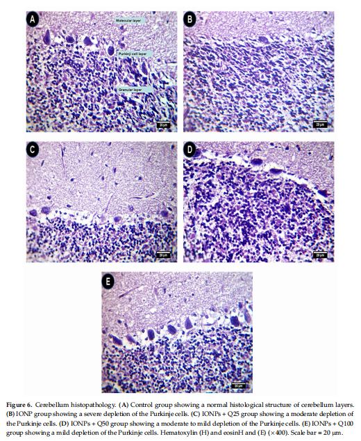 Cerebellum histopathology. (A) Control group showing a normal histological structure of cerebellum layers. (B) IONP group showing a severe depletion of the Purkinje cells. (C) IONPs + Q25 group showing a moderate depletion of the Purkinje cells. (D) IONPs + Q50 group showing a moderate to mild depletion of the Purkinje cells. (E) IONPs + Q100 group showing a mild depletion of the Purkinje cells. Hematoxylin (H) and eosinH and (E) (×400). Scale bar = 20 µm.