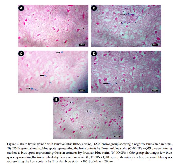 Brain tissue stained with Prussian blue (Black arrows). (A) Control group showing a negative Prussian blue stain. (B) IONPs group showing blue spots representing the iron contents by Prussian blue stain. (C) IONPs + Q25 group showing moderate blue spots representing the iron contents by Prussian blue stain. (D) IONPs + Q50 group showing a few blue spots representing the iron contents by Prussian blue stain. (E) IONPs + Q100 group showing very few dispersed blue spots representing the iron contents by Prussian blue stain. ×400. Scale bar = 20 µm