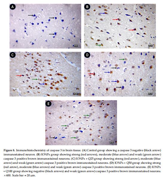 Immunohistochemistry of caspase 3 in brain tissue. (A) Control group showing a caspase 3 negative (black arrow) immunostained neuron. (B) IONPs group showing strong (red arrows), moderate (blue arrow) and weak (green arrow) caspase 3 positive brown immunostained neurons. (C) IONPs + Q25 group showing strong (red arrow), moderate (blue arrow) and weak (green arrow) caspase 3 positive brown immunostained neurons. (D) IONPs + Q50 group showing strong (red arrow), moderate (blue arrows) and weak (green arrow) caspase 3 positive brown immunostained neurons. (E) IONPs + Q100 group showing negative (black arrows) and weak (green arrow) caspase 3 positive brown immunostained neurons. ×400. Scale bar = 20 µm.