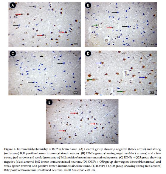 Immunohistochemistry of Bcl2 in brain tissue. (A) Control group showing negative (black arrow) and strong (red arrow) Bcl2 positive brown immunostained neurons. (B) IONPs group showing negative (black arrows) and a few strong (red arrows) and weak (green arrow) Bcl2 positive brown immunostained neurons. (C) IONPs + Q25 group showing negative (black arrows) Bcl2 brown immunostained neurons. (D) IONPs + Q50 group showing moderate (blue arrows) and weak (green arrows) Bcl2 positive brown immunostained neurons. (E) IONPs + Q100 group showing strong (red arrows) Bcl2 positive brown immunostained neurons. ×400. Scale bar = 20 µm.